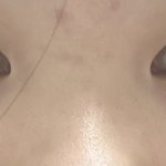 내 코는 어떤성형해야함?
