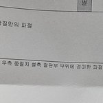 음식집에서 <b>칼날</b>나옴 이빨깨짐