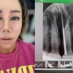 [드루와] '강원래' 김송, 큰 병원 응급실行…"암 아니냐며 눈물"...