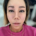 “암 아니냐며” 김송, 광대수술 후 심각한 건강이상..대학 응급실까지[Oh...