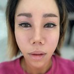 "암 아니냐고 눈물"..'강원래' 김송, 응급실 간 이유=광대수술...