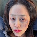 [모두드루와] 고현정, 큰<b>수술</b> 마치고 복귀한 ‘사마귀’ 마무리 “길게...