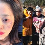 '건강악화' 고현정, 멍들고 수척한 얼굴로 '사마귀' 촬영 마쳐...