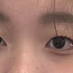 [댓글부탁해] 쌍수 라인 너무 낮나