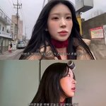 “지긋지긋한 루푸스”‥96kg→49kg 다이어트 성공에도 고통<b>ing</b>