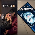 '시험관 성공' 김지혜, 쌍둥이 임신했다…'6년' <b>보상</b> 제대로