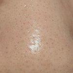 혐주의인데 <b>코에</b> 털남.. 이거 뭐야