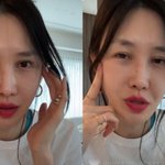 '엄태웅' 윤혜진 "어릴때 한 성형 다 망해..안면<b>거상</b>술 고민"