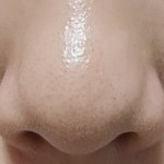 이런 <b>코</b>를 뭐라고 함?? 무슨<b>코</b>야