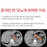 한국인이 <b>당뇨</b>에 걸릴수밖에 없는이유