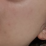 [댓글부탁해] <b>쌩얼</b>인데 피부어때?