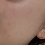 [댓글부탁해] 쌩얼인데 피부어때?
