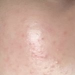 [ㅈㄱㄴ] 좁쌀<b>테러</b> 한번만 도와주세요