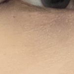 <b>악건성</b>인데 진짜 뭐가 문젤까