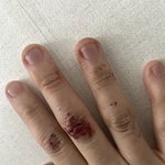 병원 갈까 말까 고민중인데 <b>판단</b>좀