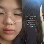 엄태웅 딸 지온, 엄마 많이 걱정시킨 눈질환..“눈팅이 밤팅이 돼”