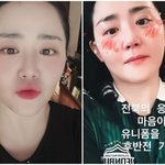 극복→살 쏙 빠진 문근영, “건강한 다이어트 대성공”[<b>MD</b>이슈]