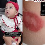 [드루와] “충격적 사진”..이지훈아야네 아기, 생각보다 심각했던...