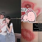 [드루와] ‘이지훈’ 아야네, 심각했던 딸 피부 상태 공개 “사실...