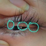 [댓글부탁해] <b>눈</b>에 난 <b>이</b> 이상한 거 대체 뭐지..??