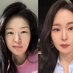 진짜 효과 본 붓기 빼는 방법들 (실패한 것도 있음)