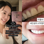 '안면 <b>부상</b>' 고은아, 치료 후 확 달라졌다 "새 인생 시작"