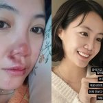 중형차 값 들인 고은아 안심,안면부상 당하고 앞니 깨지고“이젠 절대...