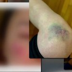 레스토랑 <b>통창</b> 깔려 전치 4주…유명 셰프, 합의금 "못 줘"