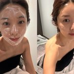 김빈우 달라진 얼굴, 볼 패임에 필러 시술 고백 “자연스럽게 넣어”