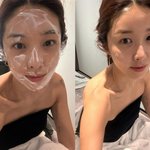 '42세' 김빈우, 확 달라진 미모에.."필러 시술" 솔직 고백