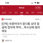 [댓글부탁해] [핫게부탁]숙명여대 미대생 눈에 강력접착제 뿌린 <b>본드</b>사건