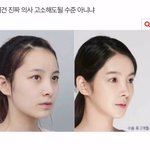 이거보고 <b>양악</b>생각 없어짐