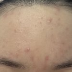 [19] 피부 약한 애들 페이스왁싱 받지 마..사진있음