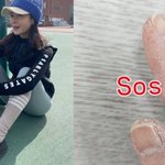 쥬얼리 출신 이지현, 너무 심각한 손 상태..쩍쩍 패여 <b>SOS</b>