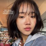 최유정, 충격적인 얼굴 근황…걸그룹인데 <b>흉터</b>들 어쩌나 '우려'