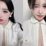 박봄, 새빨갛게 충혈된 눈 공개에 팬들 걱정 "아프지마"