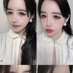 눈 실핏줄 다 터졌네…<b>박봄</b>, 누가봐도 건강 적신호