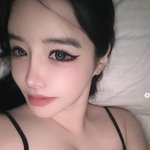 "치료 빨리해"..박봄, 침대셀카보다 걱정되는 '결막염' 심각