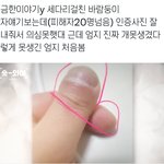 너네 소개팅남 <b>손톱</b> 이러면 어떡할거임