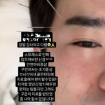 [엔터톡] 이민우, 안타까운 안면마비 <b>증세</b>…골든타임 놓치고 침 치료