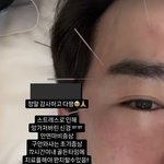 [엔터톡] 이민우 “스트레스로 안면마비…완치 힘들어”