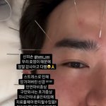 26억 사기 당한 이민우, 스트레스로 신경 망가져 안면마비 “완치...