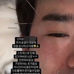 '26억 사기' 이민우, 안면마비+구안와사 고백 "골든타임 놓쳤다…완치...