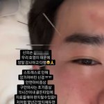 "완치 힘들다"...'26억 사기 피해' 이민우, 안면마비로...