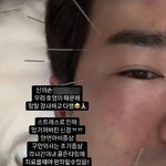 사기 피해 호소' 이민우, 안면신경마비 <b>증세</b> "완치 힘들다"