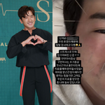 안면마비 투병 고백 "신경 망가져…완치 힘들다" [<b>소셜</b>in]