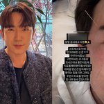 '26억 사기 피해' 신화 이민우, 안면마비 투병…"완치 힘들어"