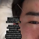 [모두드루와] '26억 사기 피해' 이민우, 스트레스로 안면마비...