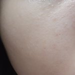 블랙<b>헤드</b>? 모공같은거 어케 없애??