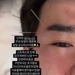 [모두드루와] 이민우, <b>안면</b>마비 고통 호소 “스트레스 탓 신경 망가져”
